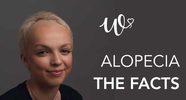 Alopecia - The Facts!