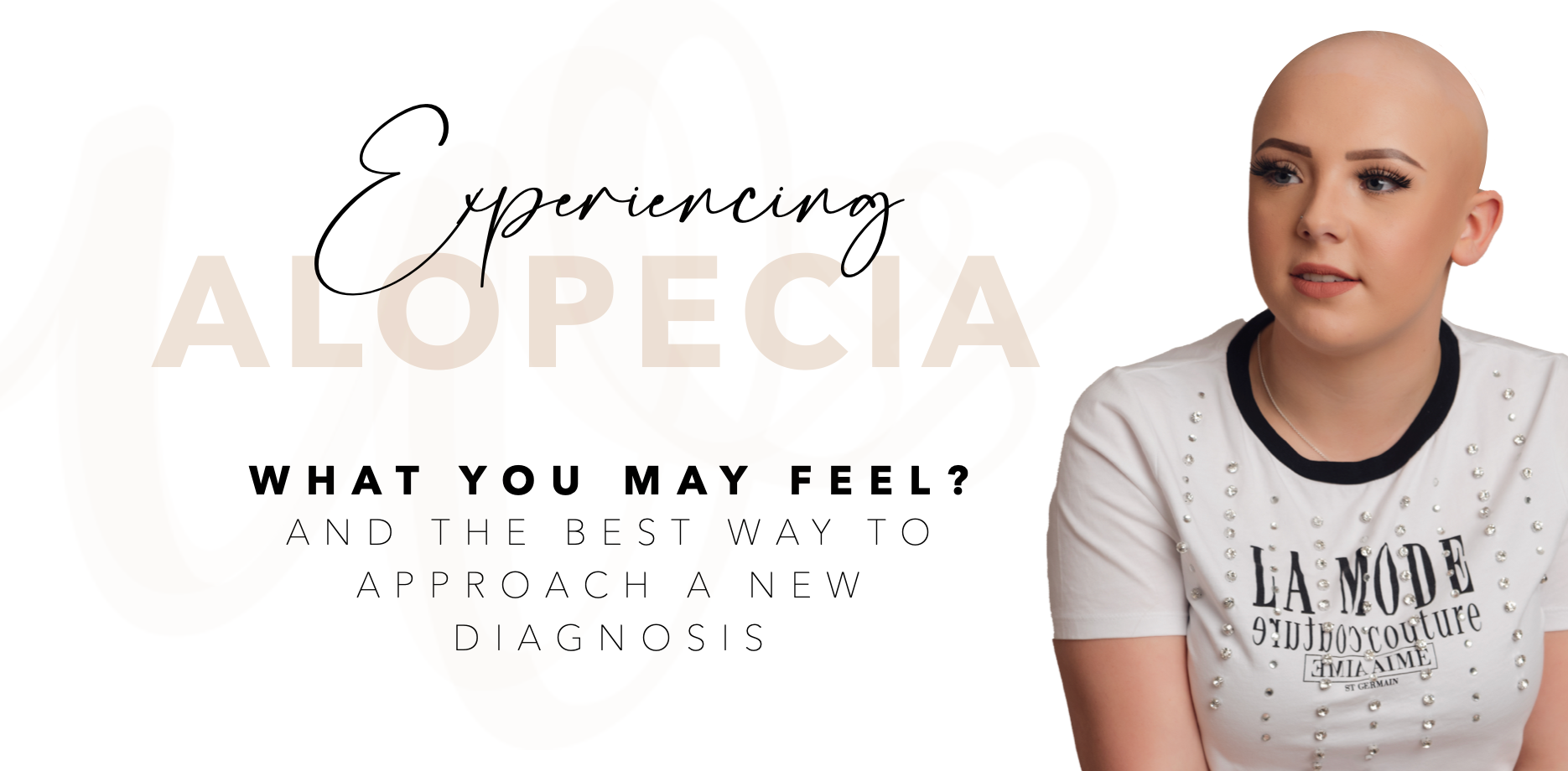 Experiencing Alopecia. What is it and how does it really feel?